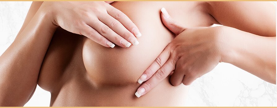 Mamoplastia de Aumento Imagem Mamoplastia de Aumento
