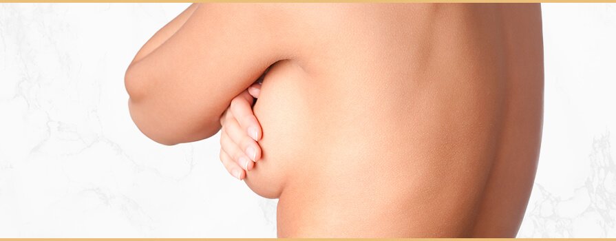Imagem Mamoplastia Redutora
