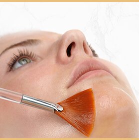 Peeling Químico